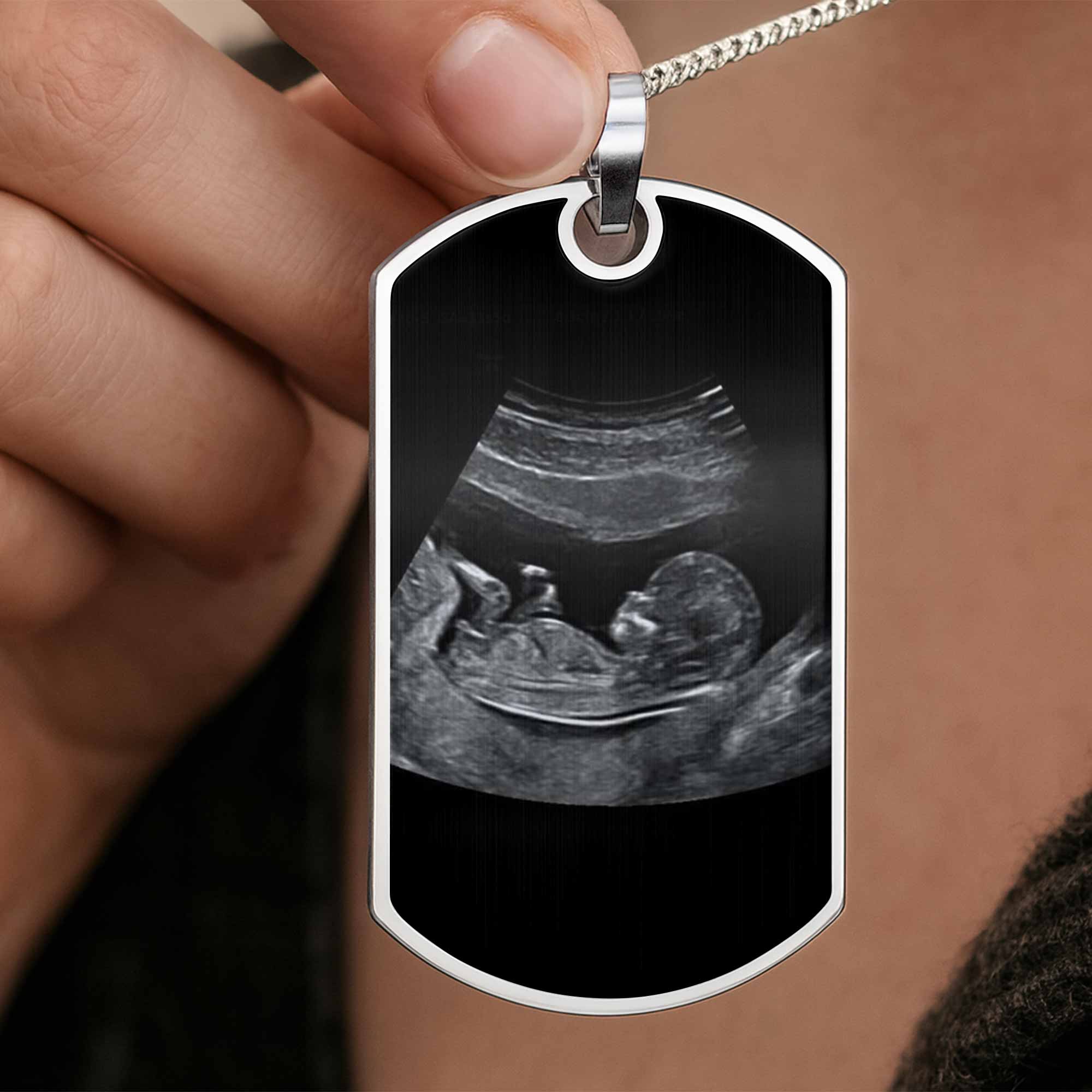 To Daddy Now You Can Carry Me Too, Ultrasound And Heart