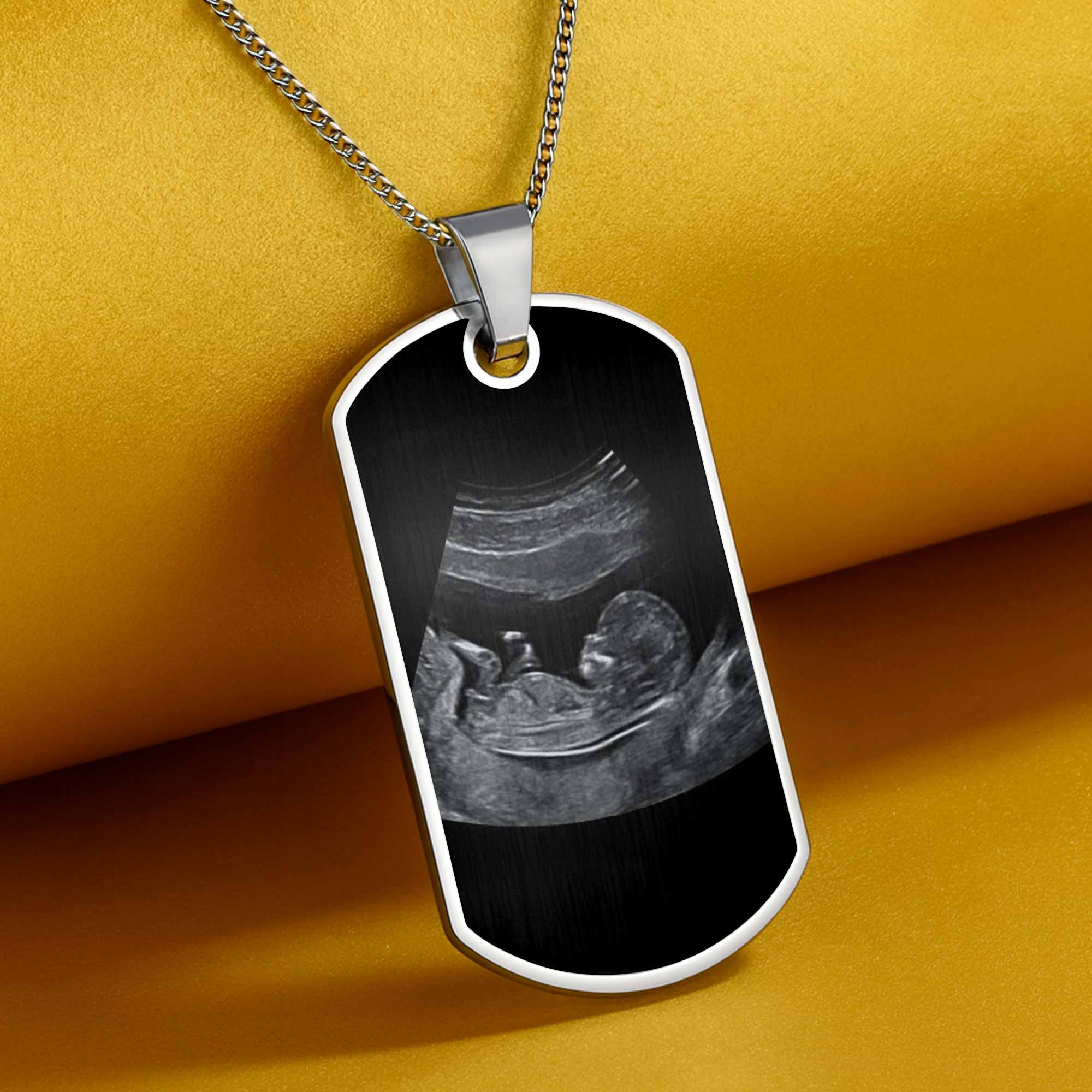 To Daddy Now You Can Carry Me Too, Ultrasound And Heart