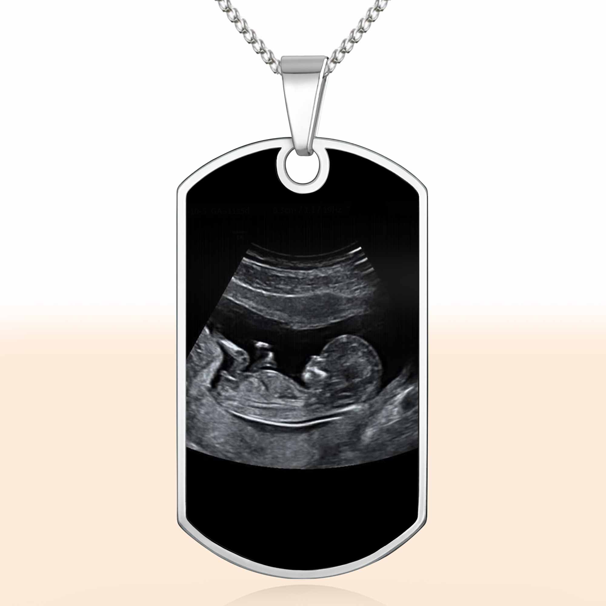 To Daddy Now You Can Carry Me Too, Ultrasound And Heart